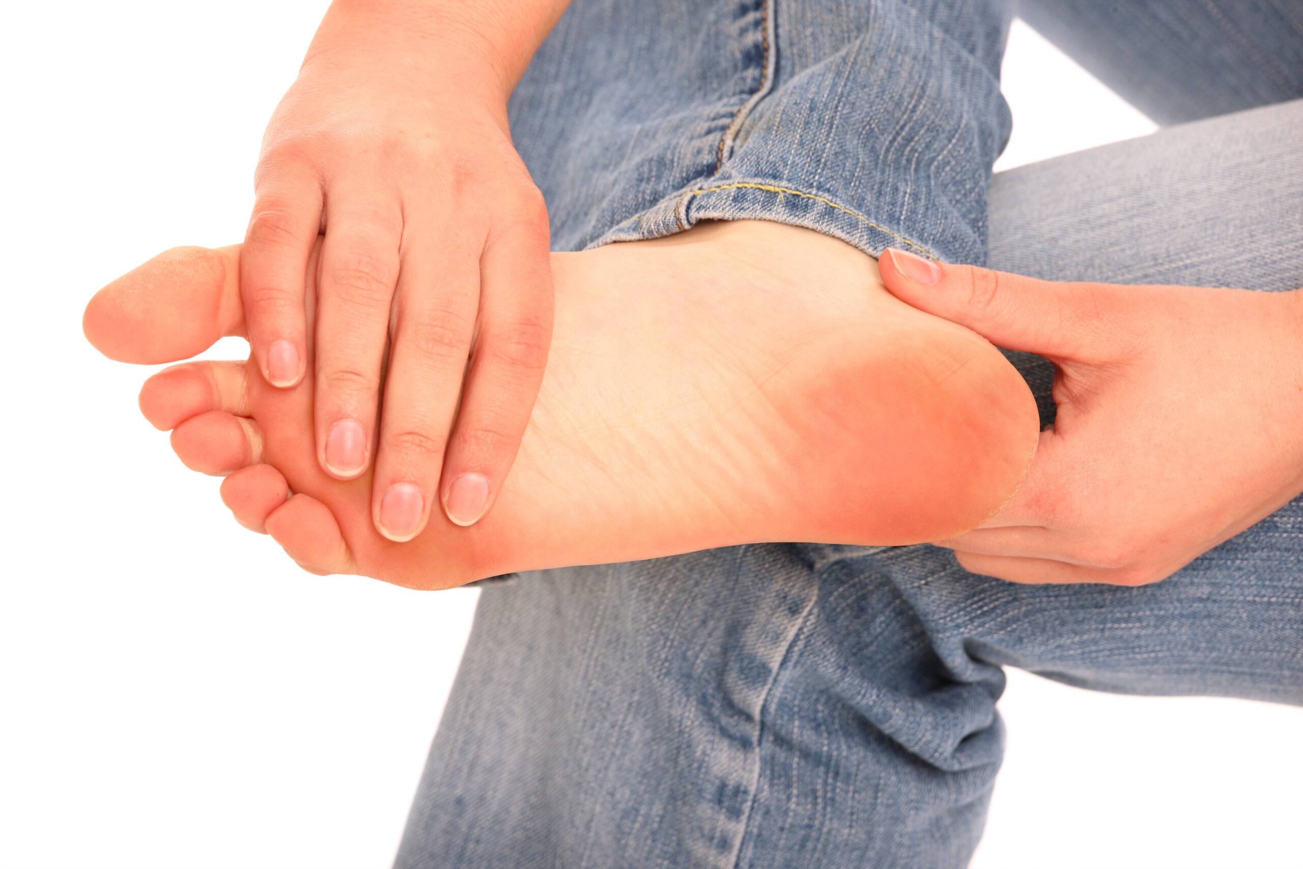 plantar fasciitis